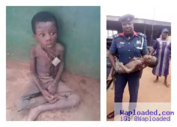 NSCDC Rescues Malnourished Boy After Celestial Church Chained Him Down For Weeks